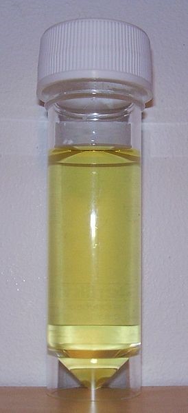 container of urine